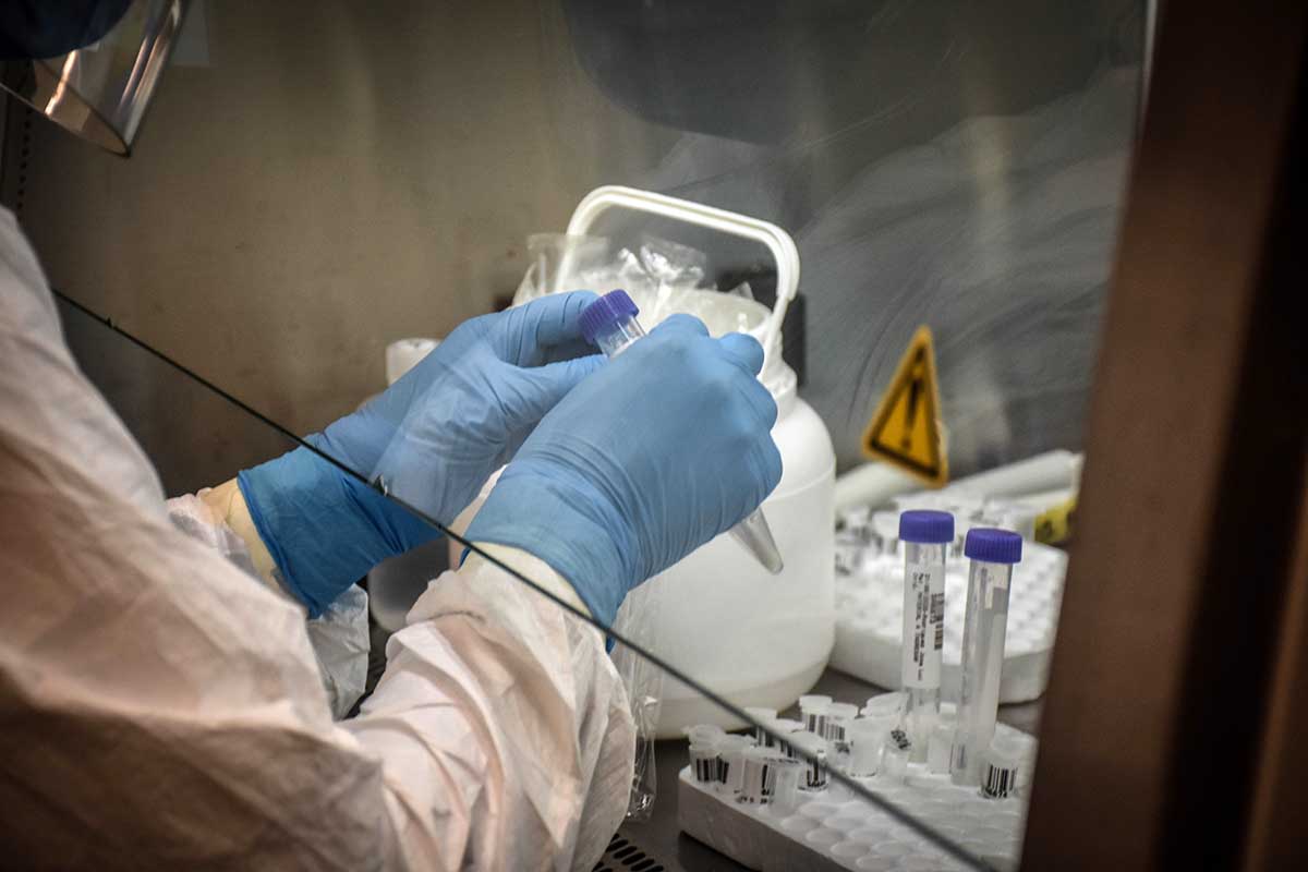 Coronavirus: afiliados de IOMA podrán hacerse testeos gratuitos en laboratorios privados
