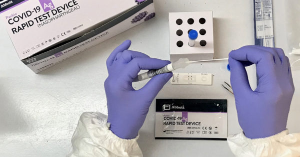 Coronavirus: los detalles del nuevo test rápido del Centro de Bioquímicos