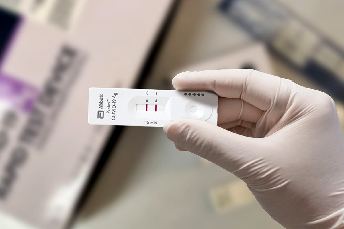 Autorizan la venta de cuatro “autotest” contra el coronavirus: ¿cómo funcionan?