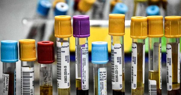 Coronavirus: unos dos mil voluntarios de Mar del Plata serán parte de un ensayo para probar una vacuna