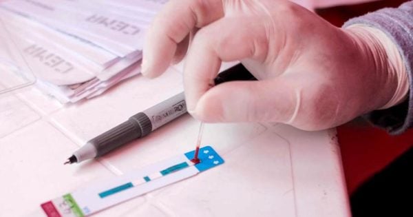 Ya se realizan test rápidos y gratuitos de VIH en Mar del Plata